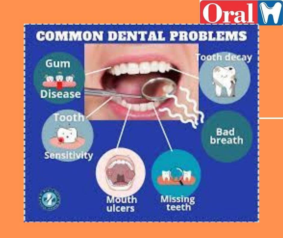 The Most Common Dental Problems
